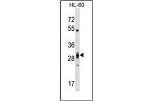 Western blot analysis of PLEKHF2 Antibody (Center) in HL-60 cell line lysates (35ug/lane).