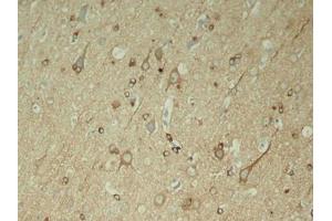 Immunohistochemical analysis of paraffin-embedded rat hippocampal region tissue from a model with Alzheimer (MAPT anticorps  (pSer396))