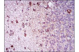 Immunohistochemical analysis of paraffin-embedded cerebellum tissues using ZEB1 mouse mAb with DAB staining.