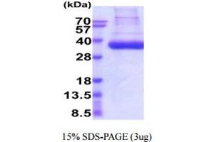 SDS-PAGE (SDS) image for Plasminogen Activator, Tissue (PLAT) (AA 36-310) protein (His tag) (ABIN6388054)