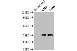 Immunoprecipitating EMD in Hela whole cell lysate Lane 1: Rabbit control IgG instead of (1 μg) instead of ABIN7151606 in Hela whole cell lysate. (Emerin anticorps  (AA 1-222))