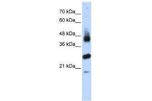 FBXL2 antibody used at 1 ug/ml to detect target protein.