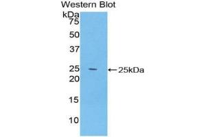 Western blot analysis of the recombinant protein. (SPRY2 anticorps  (AA 116-305))