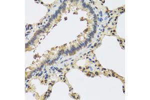 Immunohistochemistry of paraffin-embedded rat lung using IL25 antibody (ABIN5974535) at dilution of 1/100 (40x lens). (IL-25 anticorps)