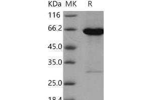 Western Blotting (WB) image for Adenosine Kinase (ADK) protein (GST tag,His tag) (ABIN7194156)
