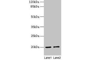 Western blot All lanes: COX4I1 antibody at 10 μg/mL Lane 1: Rat muscle tissue Lane 2: Zebrafish lysate Secondary Goat polyclonal to rabbit IgG at 1/10000 dilution Predicted band size: 20 kDa Observed band size: 20 kDa (COX IV anticorps  (Isoform 1))