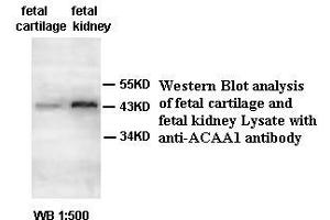 Image no. 2 for anti-Acetyl-CoA Acyltransferase 1 (ACAA1) antibody (ABIN791175) (ACAA1 anticorps)