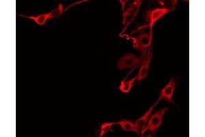 ABIN6275703 staining Hela by IF/ICC. (PTGR2 anticorps  (Internal Region))