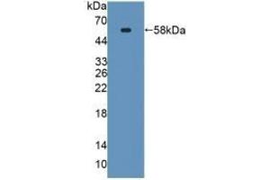 Detection of Recombinant SPTLC3, Mouse using Polyclonal Antibody to Serine Palmitoyltransferase, Long Chain Base Subunit 3 (SPTLC3) (SPTLC3 anticorps  (AA 80-563))