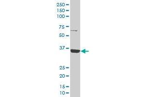 SLC35A3 polyclonal antibody (A01), Lot # 060707JCS1 Western Blot analysis of SLC35A3 expression in K-562 .