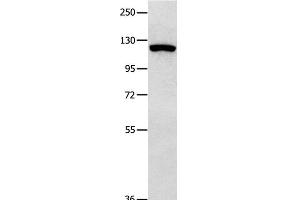 Western Blot analysis of 823 cell using MVP Polyclonal Antibody at dilution of 1:350 (MVP anticorps)