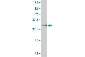 Western Blot detection against Immunogen (37. (FOXL1 anticorps  (AA 132-240))