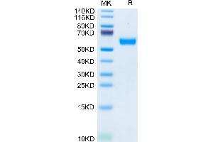Mouse CD83 on Tris-Bis PAGE under reduced condition. (CD83 Protein (CD83) (AA 22-134) (Fc Tag))