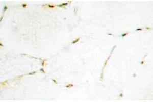 Immunohistochemistry (IHC) analyzes of Smad1/5/9 antibody in paraffin-embedded human skeletal muscle tissue. (SMAD1 anticorps)