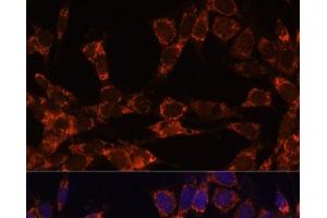 Immunofluorescence analysis of NIH-3T3 cells using UBE2F Polyclonal Antibody at dilution of 1:100. (UBE2F anticorps)