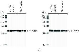 Protein expression levels in nondiabetic and diabetic gastric fundus and antrum smooth muscles.