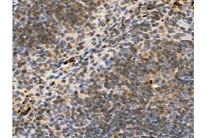 ABIN7093305 and ABIN7097324 at 1/100 staining Mouse spleen tissue by IHC-P. (TCP1 alpha/CCTA anticorps  (pSer395))