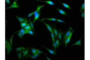 Immunofluorescence staining of Hela cells with ABIN7175826 at 1:150, counter-stained with DAPI.