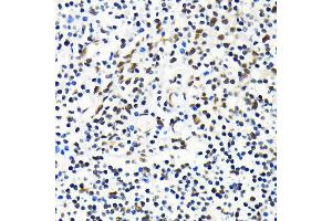 Immunohistochemistry of paraffin-embedded human tonsil using MKL1 antibody (ABIN6132380, ABIN6143855, ABIN6143858 and ABIN6224589) at dilution of 1:100 (40x lens). (MKL1 anticorps  (AA 1-280))