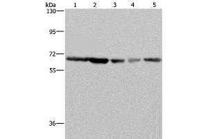 Western Blot analysis of K562, Hela, LoVo, 293T and Raji cell using GNL3 Polyclonal Antibody at dilution of 1:300 (Nucleostemin anticorps)