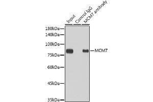 Immunoprecipitation analysis of 300 μg extracts of HeLa cells using 3 μg MCM7 antibody (ABIN7268544). (MCM7 anticorps)