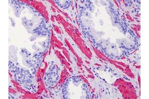 anti-Actin, gamma 2, Smooth Muscle, Enteric (ACTG2) (N-Term) antibody