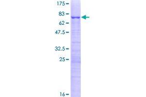 Image no. 1 for KRR1, Small Subunit (SSU) Processome Component, Homolog (KRR1) (AA 1-381) protein (GST tag) (ABIN1308949)