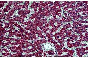 Human Liver: Formalin-Fixed, Paraffin-Embedded (FFPE)