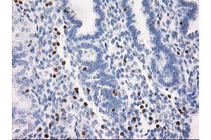 Image no. 2 for anti-Signal Transducer and Activator of Transcription 4 (STAT4) antibody (ABIN1501179)
