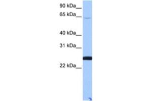 Western Blotting (WB) image for anti-Zinc Finger Protein 570-like (LOC344065) antibody (ABIN2463395) (ZFP 570-like anticorps)