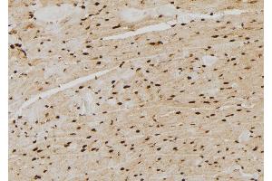 ABIN6264476 and ABIN6277705 at 1/100 staining Rat heart tissue by IHC-P.