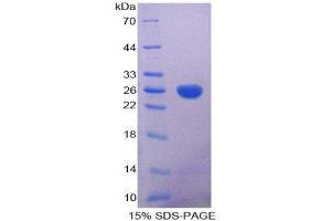 SDS-PAGE (SDS) image for Aconitase 1 (ACO1) (AA 26-243) protein (His tag) (ABIN1169744)