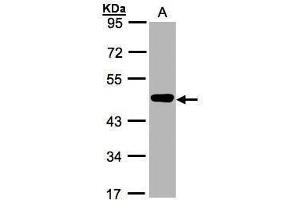 WB Image Sample(30 ug whole cell lysate) A:MOLT4 , 10% SDS PAGE antibody diluted at 1:1000 (MEK2 anticorps)