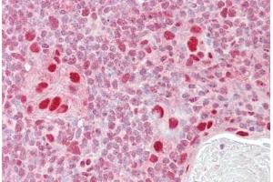Anti-MSH5 antibody IHC staining of human thymus. (MSH5 anticorps  (AA 508-519))