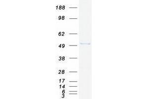 Validation with Western Blot