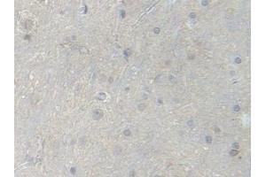 Detection of PFKM in Rat Spinal cord Tissue using Polyclonal Antibody to Phosphofructokinase, Muscle (PFKM)