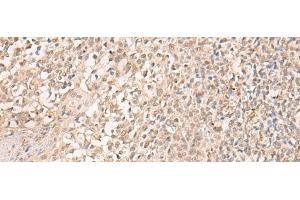 Immunohistochemistry of paraffin-embedded Human tonsil tissue using EMX2 Polyclonal Antibody at dilution of 1:25(x200) (EMX2 anticorps)