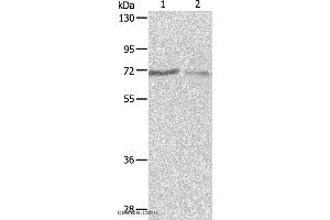 Western blot analysis of A375 and A431 cell, using PTPN6 Polyclonal Antibody at dilution of 1:500 (SHP1 anticorps)