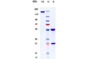 Anti-GPR73 / PROKR1 Reference Antibody (Regeneron patent anti-PROKR1) on SDS-PAGE under reducing (R) condition.