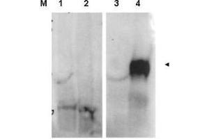 Image no. 1 for anti-Fibroblast Activation Protein, alpha (FAP) (Internal Region) antibody (ABIN1101478) (FAP anticorps  (Internal Region))