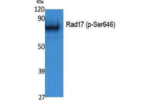 Western Blotting (WB) image for anti-RAD17 (RAD17) (pSer646) antibody (ABIN3183071) (RAD17 anticorps  (pSer646))