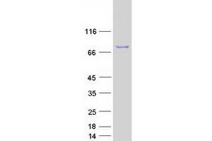 Validation with Western Blot