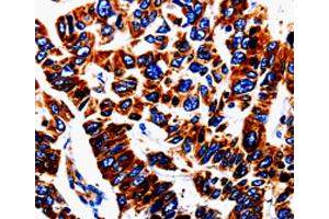 Immunohistochemistry (IHC) image for anti-Urotensin 2 (UTS2) antibody (ABIN2420949) (Urotensin 2 anticorps)