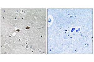 Immunohistochemistry analysis of paraffin-embedded human brain tissue, using TIGD3 antibody. (TIGD3 anticorps  (C-Term))
