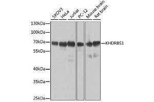 Western blot analysis of extracts of various cell lines, using KHDRBS1 antibody. (KHDRBS1 anticorps  (C-Term))