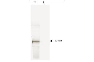 Western blot of GFP recombinant protein detected with ABIN116749.