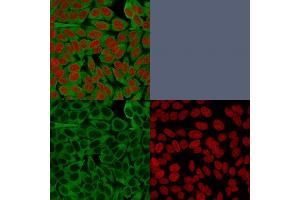 Confocal immunofluorescence image of HeLa cells using Fascin-1 Mouse Monoclonal Antibody (FSCN1/416).