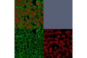 Confocal immunofluorescence image of HeLa cells using Fascin-1 Mouse Monoclonal Antibody (FSCN1/416).
