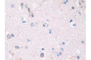 Detection of CAP1 in Human Cerebrum Tissue using Polyclonal Antibody to Channel Activating Protease 1 (CAP1)