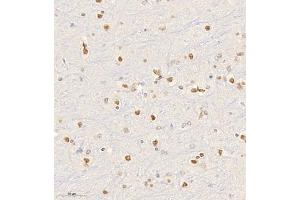 Immunohistochemistry of paraffin embedded rat brain using HRP3 (ABIN7074198) at dilution of 1:2000 (300x lens)